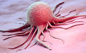 Những dấu hiệu của bệnh ung thư buồng trứng