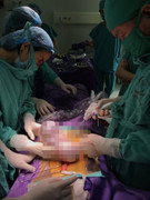 Những dấu hiệu của bệnh ung thư buồng trứng