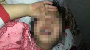 Bé gái 8 tuổi bị xâm hại nhiều lần ở Hà Nội: Phó Thủ tướng yêu cầu làm rõ