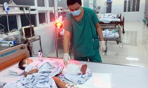 Phẫu thuật thành công, cứu sống bé trai 32 tháng tuổi bị tàu lửa cán đứt lìa cẳng chân