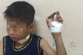 Thương tâm bé trai bị cành cây đâm xuyên qua cổ khi đang chơi đùa