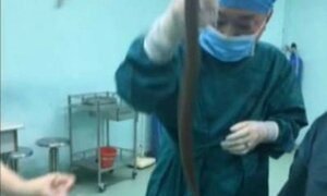 Luồn lươn sống vào cơ thể chữa táo bón, một bệnh nhân suýt chết