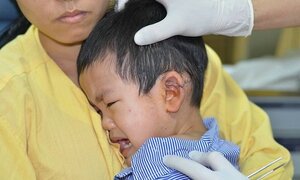 Thương tâm bé trai bị xe máy chở tôn cứa đứt ngang tai