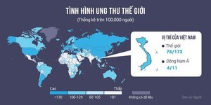 Giám đốc bệnh viện K: 65% gây ung thư là do hút thuốc và ăn uống