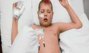 Thương tâm cậu bé ung thư cầu xin mẹ cắt bỏ đôi tay để thoát đau