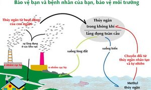 Đi hàn răng, coi chừng nhiễm độc thủy ngân vì amalgam