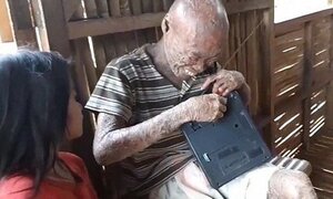 Căn bệnh lạ khiến người đàn ông trông như 'quỷ dữ', bị mọi người xua đuổi