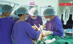 Thực hiện thành công ca phẫu thuật thay khớp gối bán phần đầu tiên tại miền Bắc