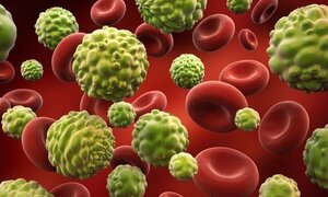 Thực hư việc bị ung thư không được ăn thịt, đường, sữa