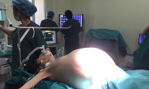 Bệnh nhân nữ có khối u buồng trứng 'khủng' 16kg to như mang thai sinh đôi