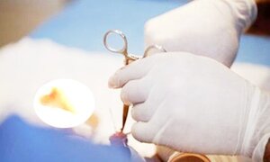 Thiếu niên gặp nạn khi cố gắng tuột bao quy đầu để 'thành người lớn'