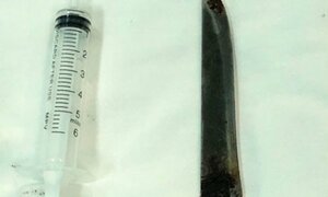 Choáng với lưỡi dao 12cm nằm trong lưng bệnh nhân nhiều năm nhưng không biết