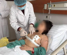 Thêm một phụ nữ ngực chảy dài được phẫu thuật thành công