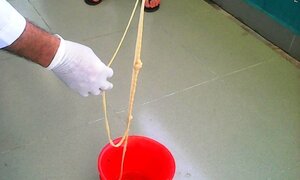 Kinh hãi con sán dài 5 m trong bụng cụ bà 82 tuổi