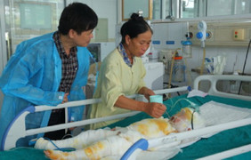 Sức khỏe 3 trẻ mầm non bị bỏng do cô giáo đốt cồn dạy học: Thông tin mới nhất