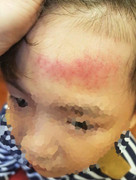 Học sinh ngã sưng đầu, hiệu trưởng bị tố 'phủi' trách nhiệm: Đại diện nhà trường nói gì?