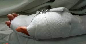 Nhân chứng kể phút nhóm côn đồ xông vào quán game chém gần lìa bàn tay người phụ nữ