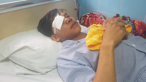 Nam thanh niên bị chém bể mắt, đứt mũi vì ‘hỗn láo’ với đàn anh