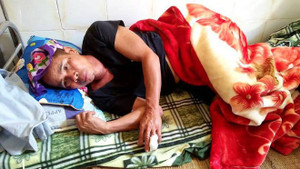 Đi làm rẫy, người đàn ông bị lợn rừng nặng gần 1 tạ tấn công