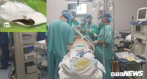 Gỡ lưới bằng miệng, người đàn ông bị cá chui vào phổi gây suy hô hấp