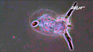 Hãi hùng phát hiện amip ăn não người trong nước sinh hoạt