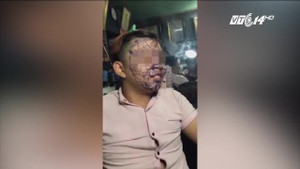 9X Long An xăm kín mặt: Lời thú nhận bất ngờ của thợ xăm