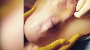 Điều kỳ diệu của cuộc sống: Chứng kiến em bé chào đời trong túi nước ối