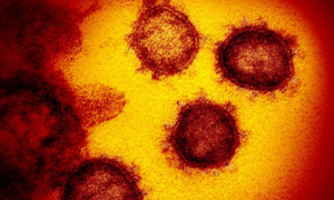 Vì sao SARS-CoV-2 dễ lây nhiễm?