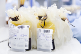 Chiết tách huyết tương - hướng điều trị mới cho bệnh nhân COVID-19 ở Việt Nam