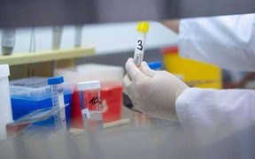 Cách ly 25 người tiếp xúc gần với bệnh nhân mắc COVID-19 thứ 266 ở Hà Nội