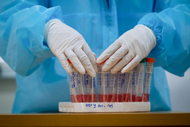 4 mẫu dương tính khi test nhanh tại chợ hoa Mê Linh âm tính với SARS-CoV-2