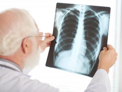 10 biến chứng nguy hiểm của bệnh COVID-19