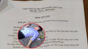 Tìm ra kẻ chủ mưu thuê côn đồ đánh cán bộ tư pháp ở Thái Bình nhập viện