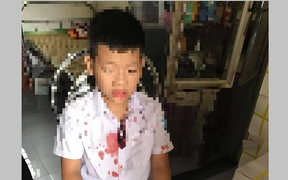 Bé lớp 1 bị bố của bạn hành hung: 'Không có người can thì hắn đánh bé đến chết'