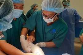 Cặp song sinh Trúc Nhi - Diệu Nhi hết sốt, ăn được sữa sau 11 ngày mổ tách rời