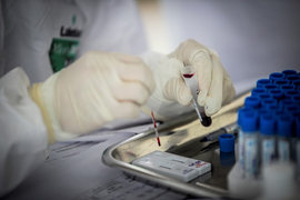 Việt Nam có thêm 1 phương pháp xét nghiệm COVID-19