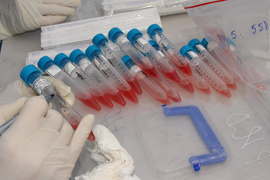 Phát hiện biến chủng SARS-CoV-2 ở các bệnh nhân Hải Dương và Quảng Ninh