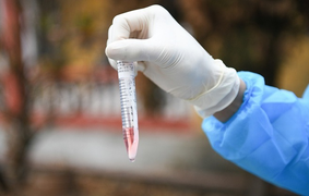 Những triệu chứng thường gặp của người nhiễm SARS-CoV-2 tại Việt Nam