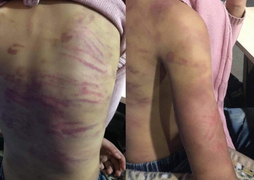 Mẹ bạo hành con ruột tại Hà Đông: Hàng xóm khiếp hãi lối hành xử của người mẹ