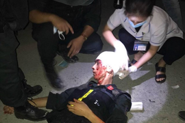 Ảnh: Hiện trường 'bắt vạ' 50 triệu/cây gỗ tạp, nhiều công an bị đánh nhập viện