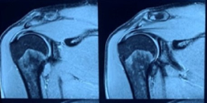 Chấn thương gì khiến Văn Toản 'bỏ lỡ' AFF Suzuki Cup 2020?