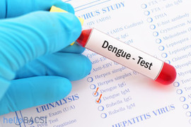 Bị sốt bao lâu mới cần xét nghiệm sốt xuất huyết?