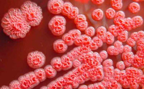 7 biện pháp phòng ngừa 'vi khuẩn ăn thịt người'