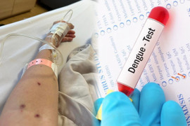 Sốt xuất huyết ở Hà Nội hạ nhiệt