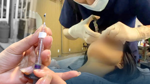 ‘Bác sỹ rởm’ tiêm filler chui: Hậu quả khủng khiếp, không thể cứu vãn