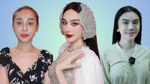 Tâm sự của người đàn ông nghiện phẫu thuật thẩm mỹ