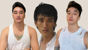 Tâm sự của người đàn ông nghiện phẫu thuật thẩm mỹ