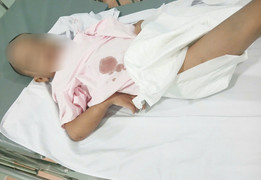 'Dì ghẻ' khai đổ nước sôi lên người để dạy dỗ bé trai 6 tuổi ở TP.HCM