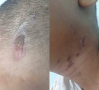 'Dì ghẻ' khai đổ nước sôi lên người để dạy dỗ bé trai 6 tuổi ở TP.HCM