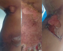 'Dì ghẻ' khai đổ nước sôi lên người để dạy dỗ bé trai 6 tuổi ở TP.HCM